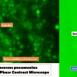 Quellung Reaction: Introduction, Principle, Procedure, Result Interpretation, Uses and Keynotes