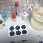 RF Test: Introduction, Principle, Testing Procedure, Result Interpretation, Normal Range and Clinical Significance