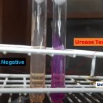 Urease Test: Principle, Procedure, Interpretation, Urease Positive Organisms, Limitations and Keynotes