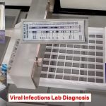 Viral Infections Lab Diagnosis: Introduction, List of Common Virus, Types of Methods and Keynotes