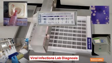 Viral Infections Lab Diagnosis: Introduction, List of Common Virus, Types of Methods and Keynotes