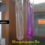 Urea hydrolyzation Test: Principle, Procedure, Interpretation, Urease Positive Organisms, Limitations and Keynotes