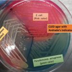 CLED Medium: Introduction, Uses,Composition, Preparation, Colony Characteristics, Modification and Limitations