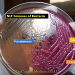 Colony Characteristics of Bacteria: Introduction, Types and Special Features of Bacteria