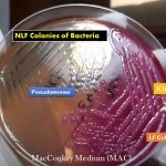 MAC: Introduction, Principle, Composition, Preparation, Procedure, Colony Morphology and Uses