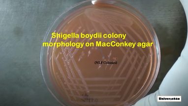 Shigella species: Introduction, Morphology, Culture Characteristics, Pathogenesis, Lab Diagnosis and Treatment