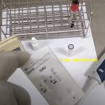 HAV Rapid IgM and IgG Test: Introduction, Principle, Procedure, Result Interpretation, Limitations and Keynotes