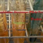 PDA Test: Introduction, Principle, Test Requirements, Procedure, Result Interpretation, Keynotes and Limitations