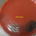 TBA for Corynebacterium: Introduction, Principle, Composition, Preparation, Procedure, Colony Morphology, Uses and Keynotes