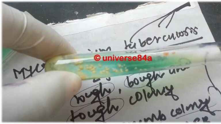 Lowenstein Jensen Lj Medium Introduction Composition Preparation