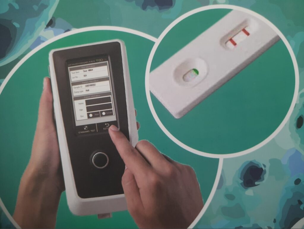 Immunochromatography Analyzer In Clinical Mycology Laboratory Introduction, Instrument Structure, Instrument Parameters, Detecting Tests, and Keynotes