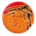 DHL Agar-Introduction, Principle, Composition, Preparation, Procedure, Colony Morphology, Uses and Keynotes