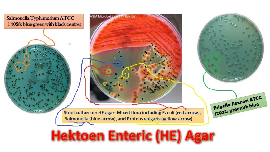 Hektoen Enteric Agar: Introduction, Principle, Composition, Preparation, Procedure, Colony Morphology, Uses and Keynotes