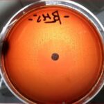 Neomycin Blood Agar: Introduction, Principle, Composition, Preparation, Procedure, Colony Morphology, Uses and Keynotes