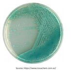 Pseudomonas agar: Introduction, Principle, Composition, Preparation, Procedure, Colony Morphology, Uses and Keynotes