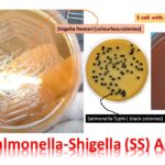 SS Agar: Introduction, Composition, Principle, Procedure, Results- Interpretation, Uses,Limitations, and Keynotes