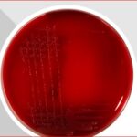 Schaedler Agar: Introduction, Principle, Composition, Preparation, Procedure, Colony Morphology, Uses and Keynotes