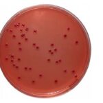 Yersinia Selective Agar: Introduction, Principle, Composition, Preparation, Procedure, Colony Morphology, Uses and Keynotes