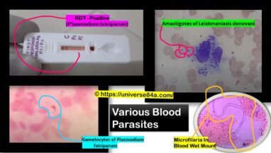 Blood Parasite- Introduction, Morphology, Pathogenicity, Lab Diagnosis, Treatment,Prevention, and Keynotes_