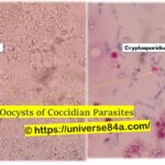 Coccidian Parasites-Introduction, Morphology, Pathogenicity, Lab Diagnosis, Treatment, Prevention, and Keynotes