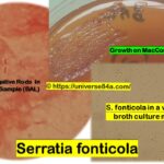 Serratia fonticola- Introduction, Morphology, Pathogenicity, Lab Diagnosis, Treatment,Prevention, and Keynotes