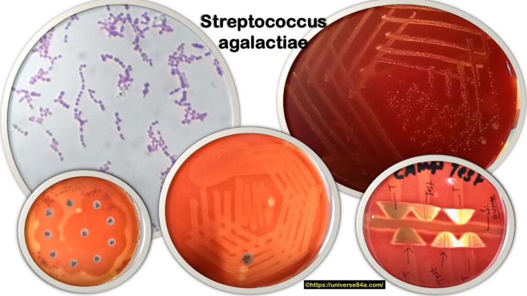 Streptococcus agalactiae: Introduction, Morphology, Pathogenicity, Lab Diagnosis, Treatment, Prevention and Keynotes