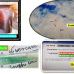 Tuberculosis-Introduction, Causative Agent, Lab Dignosis, Treatment, Prevention, and Keynotes