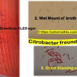 Citrobacter freundii: Introduction, Morphology, Pathogenicity, Lab Diagnosis, Treatment, Prevention, and Keynotes