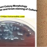 Citrobacter koseri- Introduction, Morphology, Pathogenicity, Lab Diagnosis, Treatment, Prevention, and Keynotes