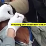 Leprosy Nodules and Skin Lesions: Introduction, Objective, Slit Skin Smear Requirements, Procedure, and Precaution