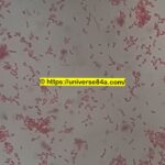Shigella sonnei: Introduction, Morphology, Pathogenicity, Lab Diagnosis, Treatment, Prevention, and Keynotes