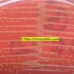 Staphylococcus lentus colomy morphology on CLED agar of old man Urine culture_