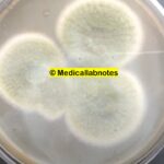 A. fumigatus: Introduction, Morphology, Pathogenicity, Lab Diagnosis, Treatment, Prevention, and Keynotes