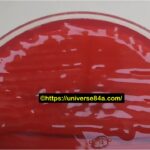 Enterobacter cloacae: Introduction, Morphology, Pathogenicity, Lab Diagnosis, Treatment, Prevention, and Keynotes