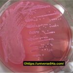 Escherichia coli: Introduction, Morphology, Pathogenicity, Lab Diagnosis, Treatment, Prevention, and Keynotes