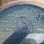 Proteus mirabilis- Introduction, Morphology, Pathogenicity, Lab Diagnosis, Treatment, Prevention, and Keynotes