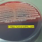 E. cloacae: Introduction, Morphology, Pathogenicity, Lab Diagnosis, Treatment, Prevention, and Keynotes