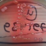 Klebsiella oxytoca- Introduction, Morphology, Pathogenicity, Lab Diagnosis, Treatment, Prevention, and Keynotes