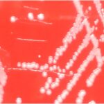 Moraxella catarrhalis-Introduction, Morphology, Pathogenicity, Lab Diagnosis, Treatment, Prevention, and Keynotes