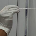 Nasal Swab Culture and Sensitivity Test-Introduction, Report, Clinical Significance, Common Pathogens, and Keynotes