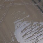 Serratia liquefaciens: Introduction, Morphology, Pathogenicity, Lab Diagnosis, Treatment, Prevention, and Keynotes