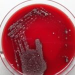 Throat Swab Culture on 5% sheep blood agar showing mixed bacterial growth