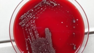 Throat Swab Culture on 5% sheep blood agar showing mixed bacterial growth