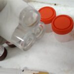 CSF Culture and Sensitivity Test-Introduction, Report, Clinical Significance, Common Pathogens, and Keynotes