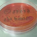 CVP Line Culture and Sensitivity Test-Introduction, Report, Clinical Significance, Common Pathogens, and Keynotes