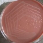 H. influenzae - Introduction, Morphology, Pathogenicity, Lab Diagnosis, Treatment, Prevention, and Keynotes