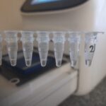 Molecular Basis of Bacterial Identification-Introduction, Molecular Methods, Keynostes, and Further Readings