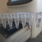 Molecular Basis of Fungus Identification-Introduction, Molecular Methods, Keynoytes, and Further Readings