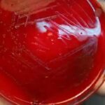 Streptococcus pneumoniae-Introduction, Morphology, Pathogenicity, Lab Diagnosis, Treatment, Prevention, and Keynotes