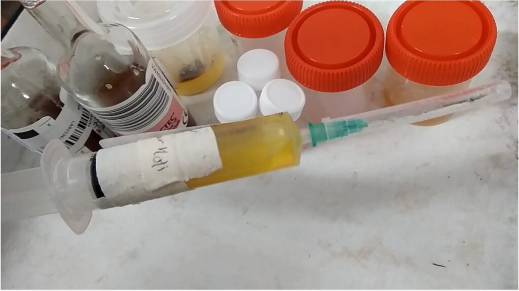 Synovial Fluid Culture and Sensitivity Test-Introduction, Report, Clinical Significance, Common Pathogens, and Keynotes